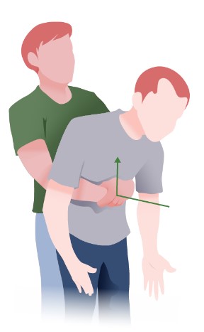 Manobra de Heimlich sendo realizada em adulto